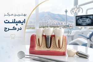 بهترین مرکز ایمپلنت در کرج