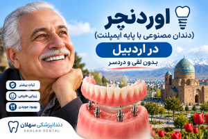 اوردنچر در اردبیل