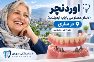 اوردنچر در ساری