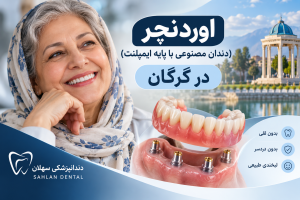 اوردنچر در گرگان
